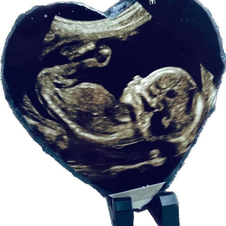 The Premium Heart Photo Slate