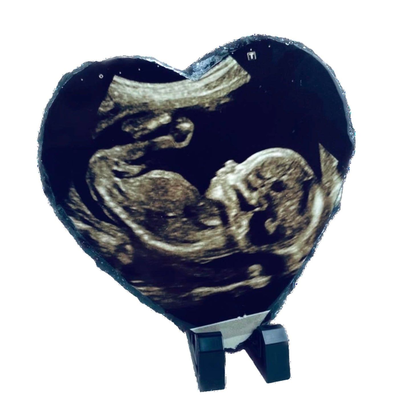 Pregnancy Photo Slate Package